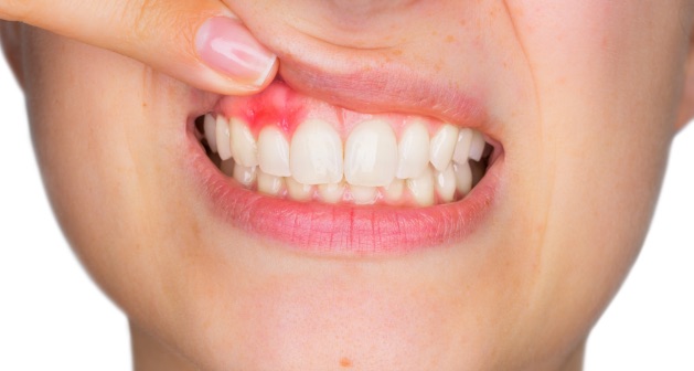 Dentista per bambini a Fondi | Parodontologia | Regno Dei Dentini